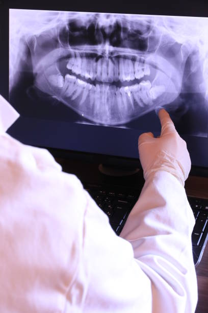 Best Emergency Tooth Extraction in Lincolnia, VA