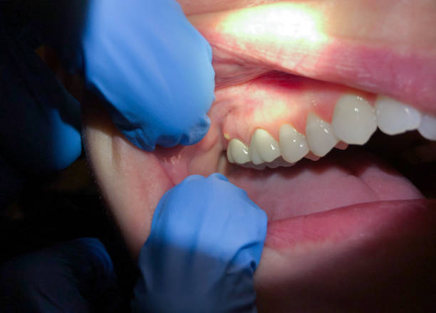 Best Urgent Dental Care in Lincolnia, VA