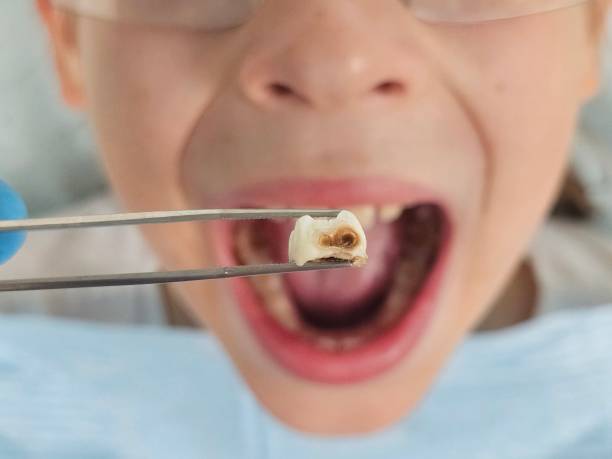 Best Walk-In Emergency Dentist in Lincolnia, VA
